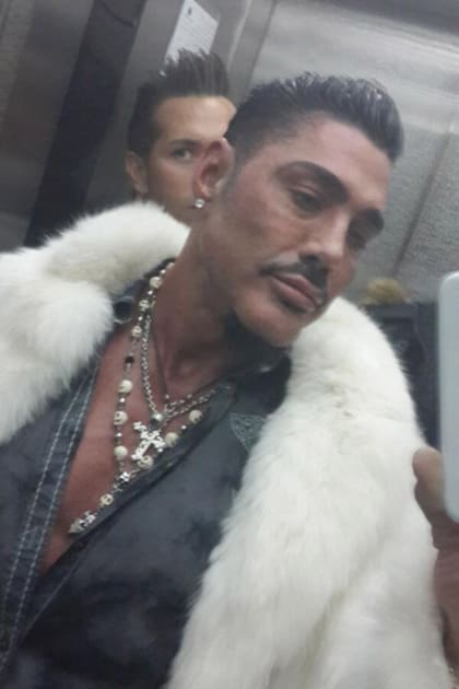 Ricardo Fort indignó a las asociaciones de protección animal