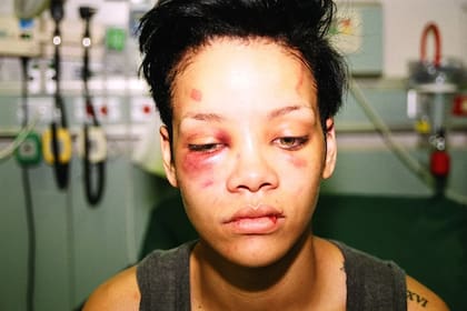 Rihanna y una foto que dio vueltas al mundo y dejó en evidencia a su expareja Chris Brown