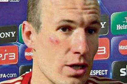 Robben, en la zona mixta tras el partido