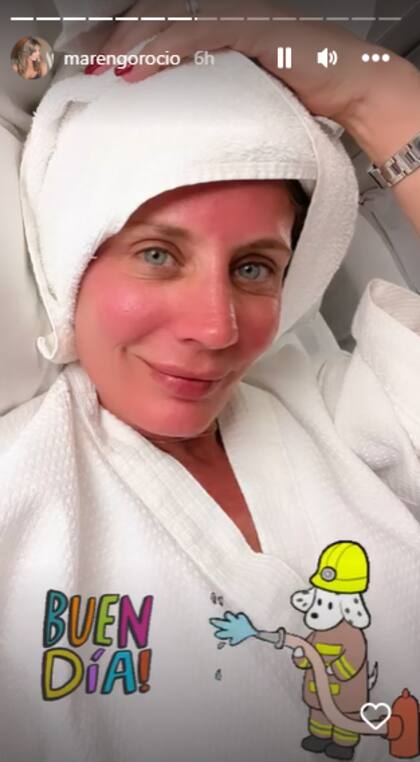 Rocío Marengo se quemó la cara durante sus vacaciones en Brasil