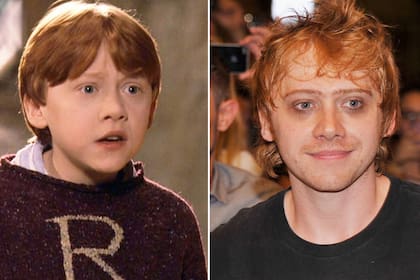 Rupert Grint, antes y después