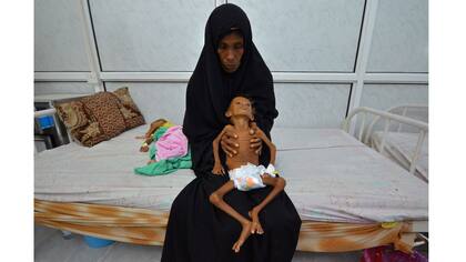 Salem Abdullah Musabih, de 6 años, es sostenido por su madre en un hospital de la ciudad portuaria de Hodaida
