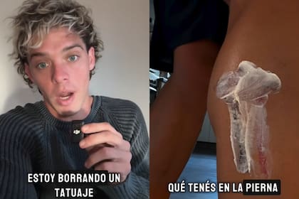 Santi Maratea contó el motivo por el cual decidió borrarse un tatuaje de la pierna (Foto: Captura de video / Instagram @santimaratea)