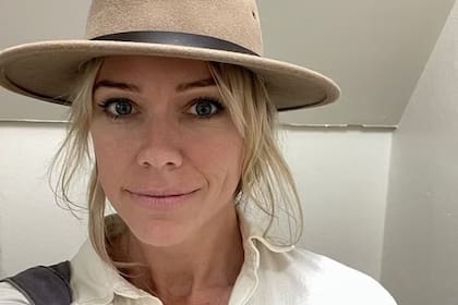 Sarah O'Brien fue diagnosticada con carcinoma de células basales