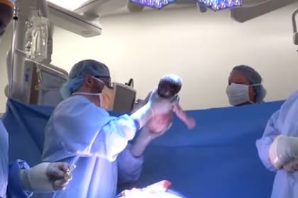 Se considera que la niña tiene dos nacimientos (Captura video Inside Edition)