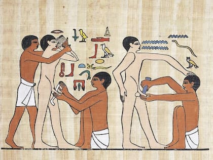 Se cree que la circuncisión se practicó primero en Egipto