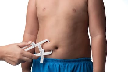 Se cree que las medidas sociales contra la obesidad han tenido algún efecto sobre las tasas de obesidad infantil. Pero los resultados son lentos