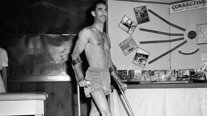 Se estima que un número significativo de estadounidenses sufre las secuelas de la poliomelitis