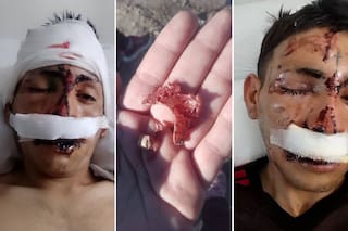 Se negó a darles dinero para comprar vino y le desfiguraron la cara a ladrillazos y golpes