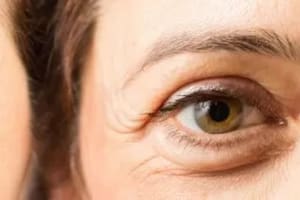 Se tratan de signos naturales del envejecimiento: el aliado natural para combatirlo