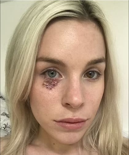 Se tuvo que someter a varias cirugías estéticas para lograr el resultado que quería (Foto: Gentileza Daily Mail)