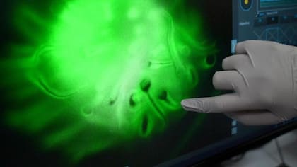 Se utiliza luz verde para iluminar una pequeña muestra de piel cultivada en un laboratorio. El dedo señala los folículos de pelo