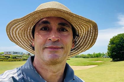 Sebastián Estevanez deberá tener mucho más cuidado con su piel mientras se recupera de las quemaduras que sufrió