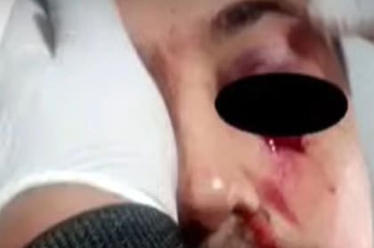 Según contó su esposa, Esteban B. podría perder la visión de un ojo a partir de las lesiones recibidas.