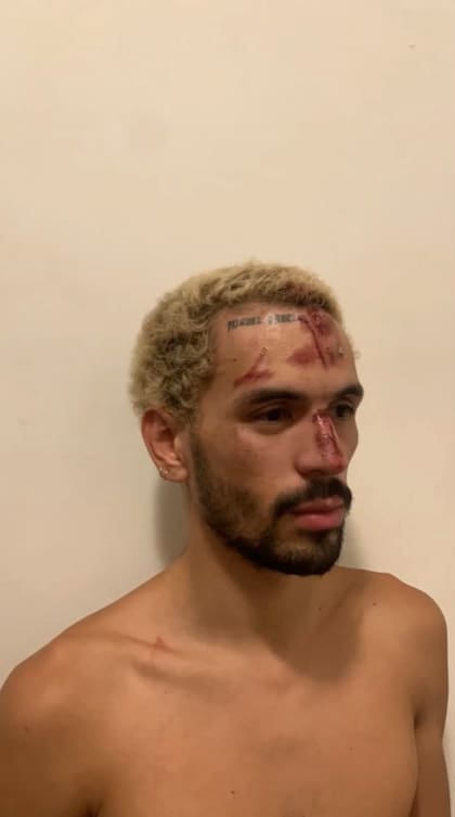 Según cuenta Callejas, cuando preguntó el motivo por el cual lo sacaron le argumentaron: “Algunos clientes se habían quejado de la forma en que yo bailaba”