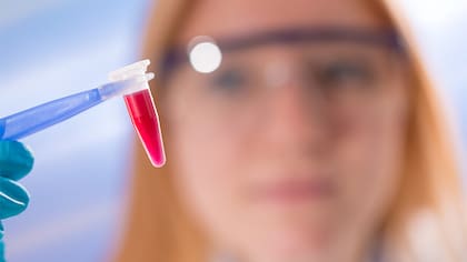 Según la American Cancer Society, la anemia puede ser el primer indicio de un cáncer de la sangre, en particular del Síndrome Mielodisplásico (SMD) .