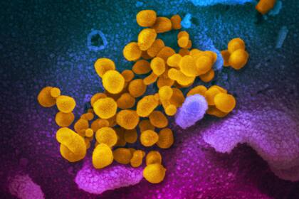 Según la OMS, el “patógeno X” es un agente infeccioso aún desconocido que podría desencadenar la próxima pandemia
