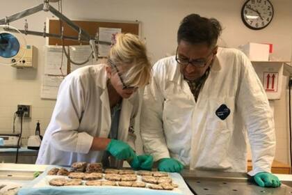 Según los investigadores, el caso de Hernández es el más grave que han encontrado en un jugador de apenas 27 años. (Foto: Boston University)