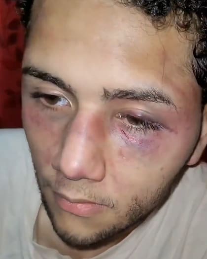 Según relató, recibió golpes de puño y con un palo
