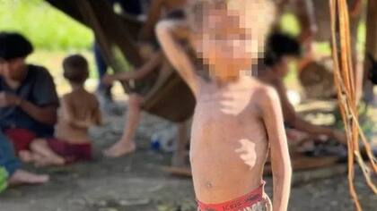 Según un cálculo del gobierno, 570 niños yanomami han muerto en los últimos cuatro años.