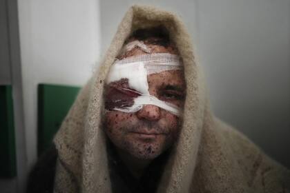 Serhiy Kralya, de 41 años, mira a la cámara tras ser operado en un hospital de Mariupol, en el este de Ucrania, el 11 de marzo de 2022. Kralya resultó herido durante un bombardeo de las fuerzas rusas.
