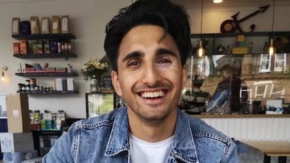 Shankar Jalota padece vitíligo, una condición que ha cambiado la percepción que tienen los demás sobre él