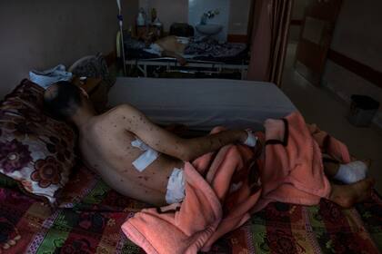 Sharif Al-zaharna, de 33 años, descansa en el hospital Shifa en la ciudad de Gaza, el jueves 13 de mayo de 2021, donde recibe tratamiento por las heridas causadas por un ataque israelí del 10 de mayo que golpeó una casa cercana a su familia en la ciudad de Jabaliya. Hace apenas unas semanas, el débil sistema de atención médica de la Franja de Gaza estaba luchando con un aumento desbocado de casos de coronavirus. Ahora, los médicos de todo el abarrotado enclave costero están tratando de mantenerse al día con una crisis muy diferente: heridas por explosiones y metralla, cortes y amputaciones. (Foto AP / Khalil Hamra)