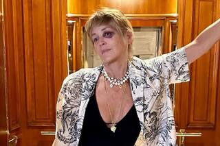 Sharon Stone llevó tranquilidad a sus seguidores y reveló el misterio de su ojo morado