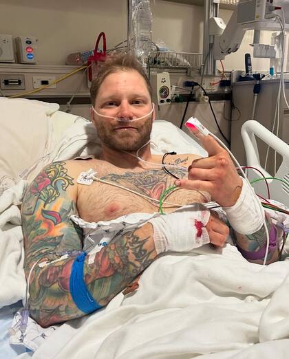 Shayne Patrick fue internado luego del brutal ataque de un oso