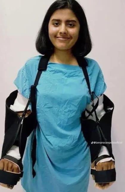 Shreya Siddanagowda pasó por una cirugía que necesitó de 20 cirujanos y 16 anestesiólogos