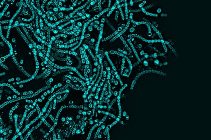 Si bien las bacterias están normalmente asociadas a distintos tipos de enfermedades, sólo el 1% de las que están presentes en el organismo enferma