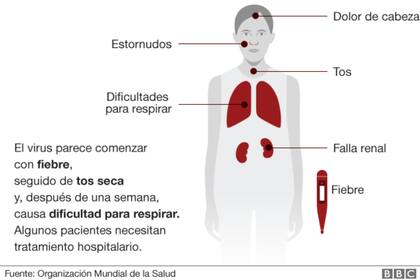 Síntomas del coronavirus originado en China