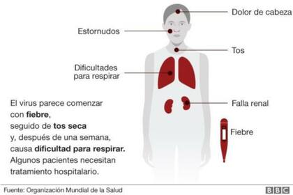 Síntomas del coronavirus originado en China