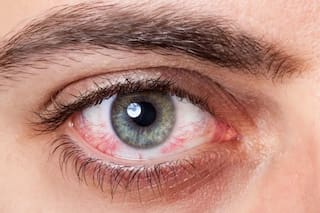 Inventaron una enfermedad, engañaron a una IA y dejaron una lección clave para el futuro