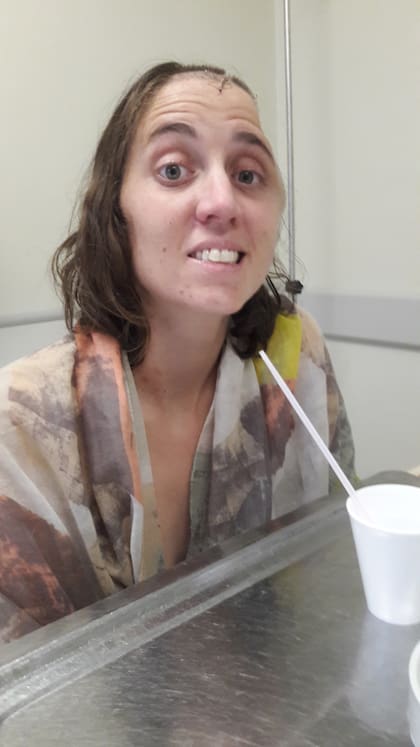 Sofía Bauzá en el FLENI con la "cabeza hundida", tras atravesar una neurocirugía por el ACV