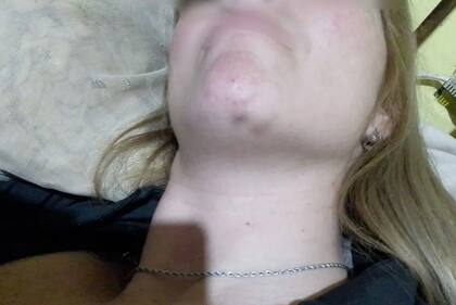 Soledad, la mujer que denunció a los rugbiers franceses Hugo Auradou y Oscar Jegou, dio a conocer algunas fotos de las marcas en su cuerpo tras las agresiones