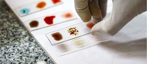 Por qué los científicos están intentando cultivar un tipo raro que solo tienen 50 personas en el mundo