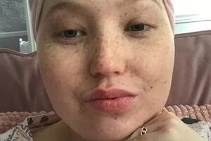 Sophie Wheldon recibió su diagnóstico cuando era estudiante