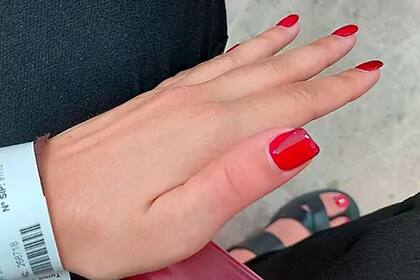 Su pulgar se puso rápidamente colorado y le ardía mucho como si se estuviera quemando, contó Judith