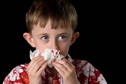 Suele ser común la presentación de sangrado de nariz en los niños (Foto Pexels)