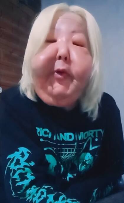 Sus seguidores le brindaron apoyo durante todo este proceso (Foto: @oliveirajuju35)