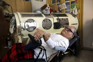 Falleció por Covid una de las últimas sobrevivientes de la epidemia de polio en el mundo