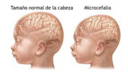 Tamaños de cabeza en bebes