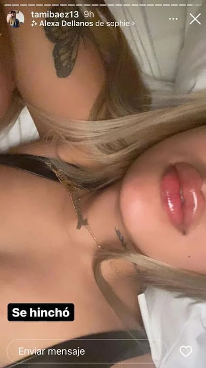 Tamara Báez se rellenó los labios y mostró el resultado en sus redes sociales