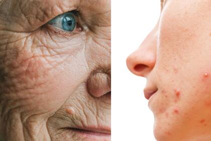 Tanto jóvenes como adultos pueden llevar a cabo estos tratamientos para diversas afecciones