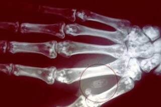 Así funciona el pago sin efectivo ni tarjeta con chips implantados bajo la piel