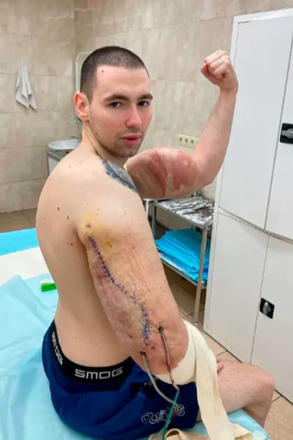 "Tengo mucho miedo. Debería haber pensado en esto antes, lo sé", dijo
Kirill Tereshin, el "Popeye ruso"