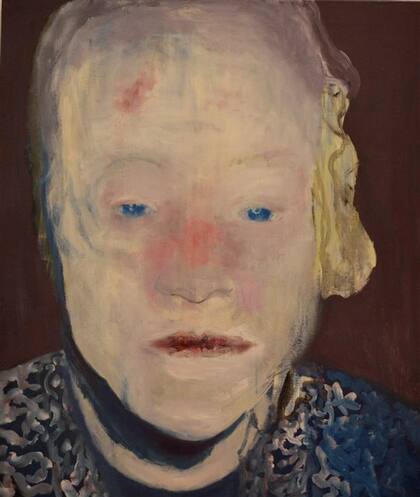 The white desease (1985). Marlene Dumas, una de las artistas vivas mejor cotizadas del mundo, refleja cuerpos que padecen violencia.