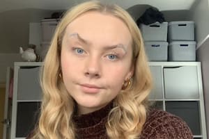 Tia-Leigh Streamer contó el calvario que sufre tras vivir sin poder abrir los ojos por su cuenta