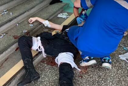 El hombre fue detenido tras el ataque